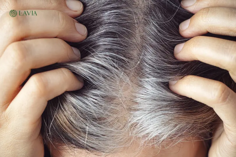 Dầu gội đầu phủ bạc: Giải pháp hiệu quả cho tóc bạc và tóc bạc